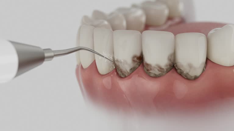 Trusted Tooth Extraction service in Dayton, TX - Dentist Open Now